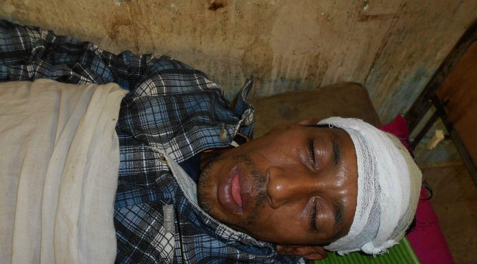 চরফ্যাশনে মেম্বার প্রার্থীর বাড়িতে হামলা,আহত নারীসহ ৩৩