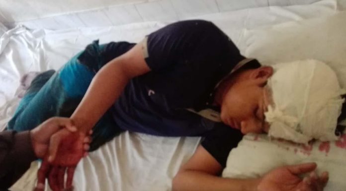 লালমোহনে প্রতিপক্ষের হামলায় আহত-৩