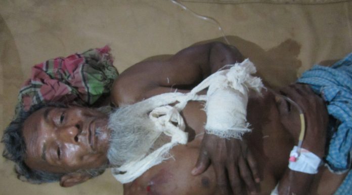 ভোলায় জমিজমার বিরোধকে কেন্দ্র করে মহিলাসহ আহত ৫