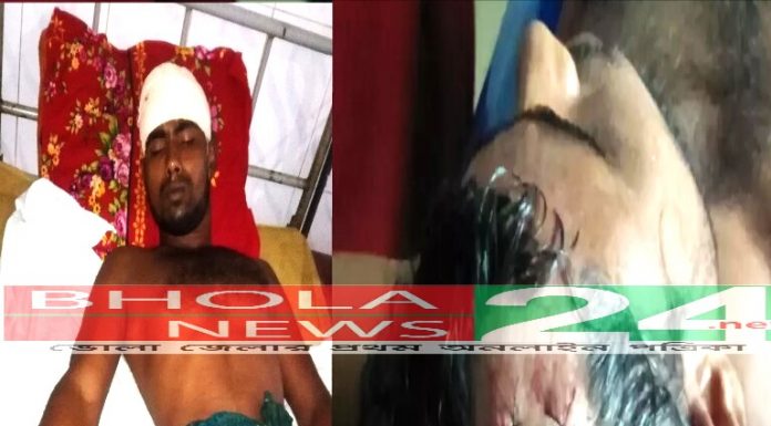 লালমোহনের রমাগঞ্জে জমি-জমা নিয়ে সংঘর্ষ !! আহত : ২