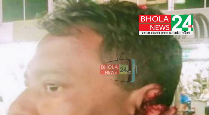 চরফ্যাশনে বিএনপি’র নেতাকে হত্যার উদ্দেশ্যে হামলার অভিযোগ