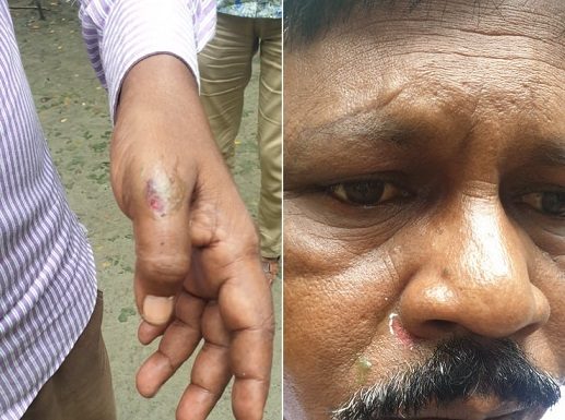 মনপুরায় নির্বাচন পরবর্তী সহিংসতা : স্কুল শিক্ষকের উপর হামলা : আতংকিত পরাজিত সমর্থকরা